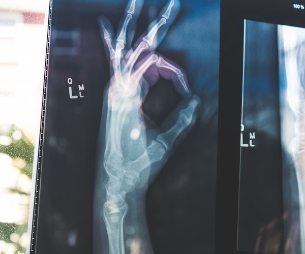 x ray